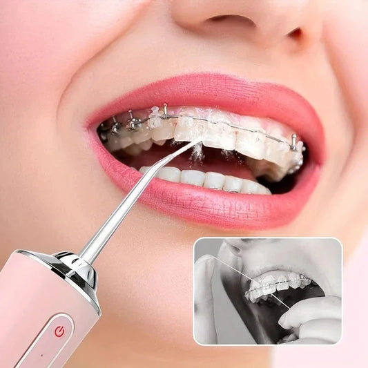 Portable Water Flosser – USB Rechargeable Oral Irrigator, 200ml